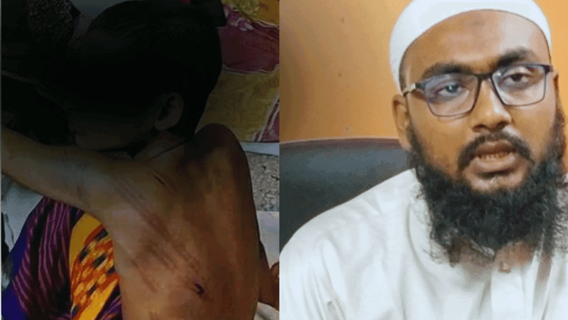 Child student seriously injured by madrasa teacher