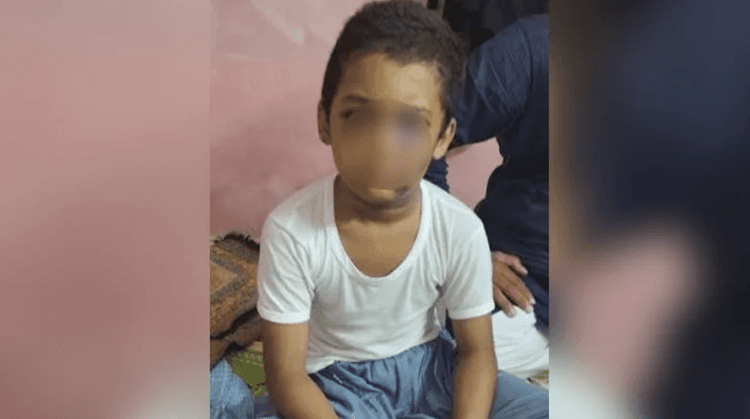 Child suffers brain haemorrhage after Madrasa teacher's beating in Khulna