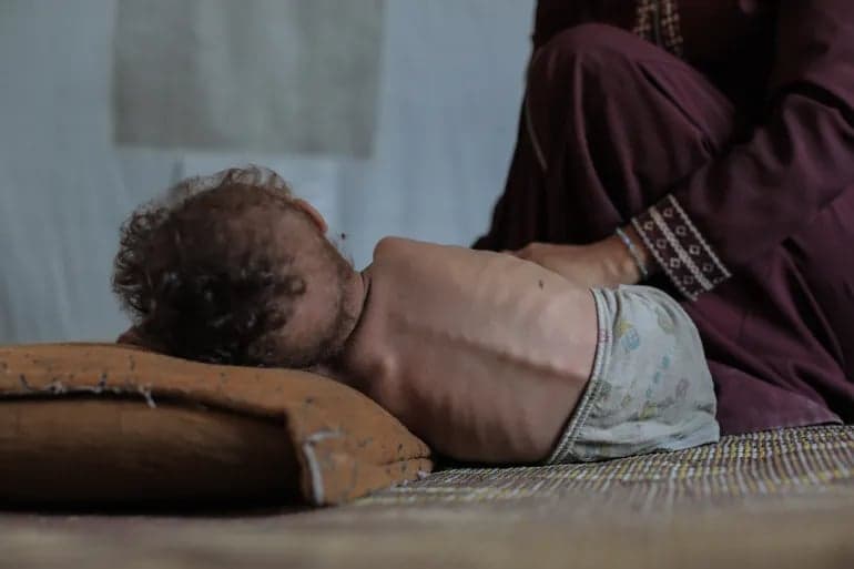 61,599 Palestinians killed in Israeli strikes on Gaza, 227 dead from ‘famine’