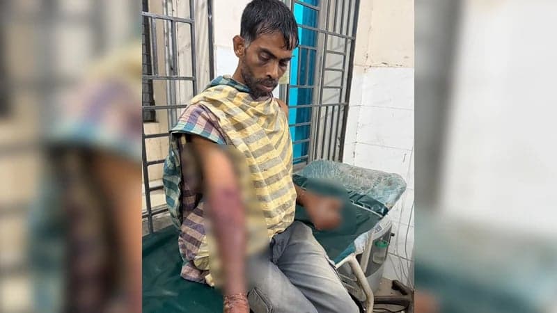Youth tied to electric pole, beaten with pipe, hands burned with acid in Satkhira