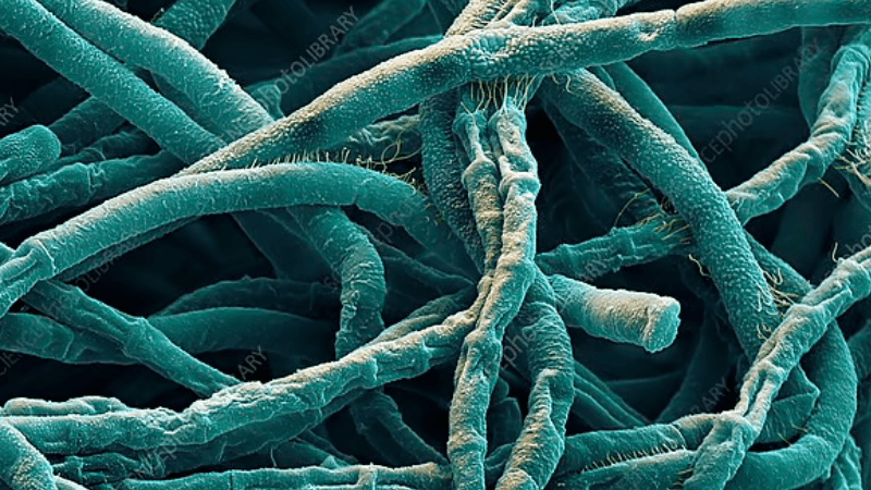 Anthrax outbreak in Rangpur, patients with symptoms in two more upazilas