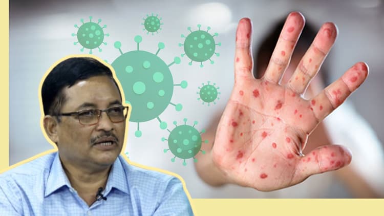 Along with measles, children are being infected with adenovirus: Dr. Muaz