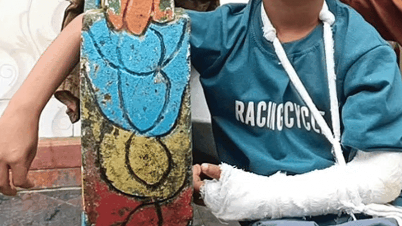 Child suffers fractured arm in beating by madrasa teacher in Manikganj