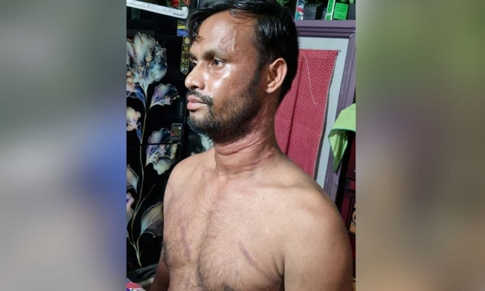 Man held for 'killing' daughter-in-law over dowry