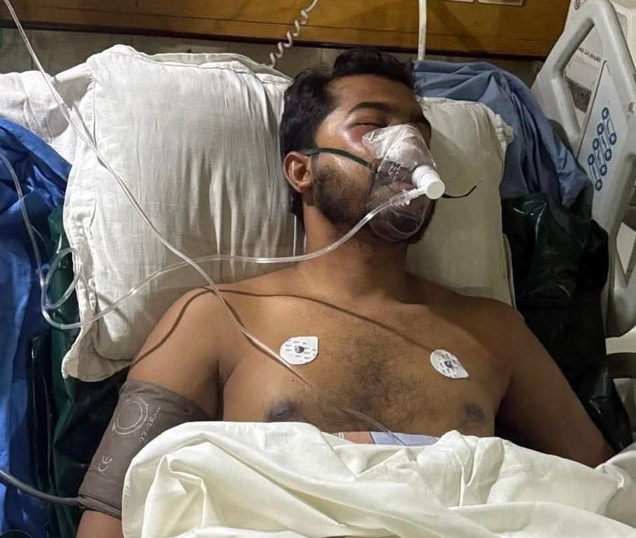 Nur at ICU