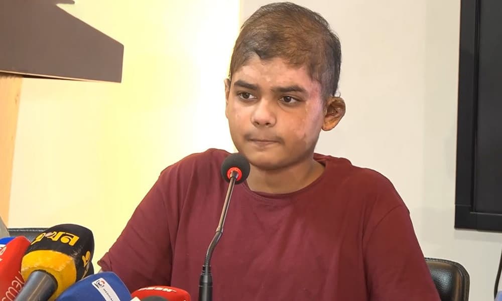 Milestone Tragedy: Burn victim Arian released after 122 days