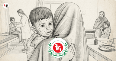 3 more die with measles symptoms in 24 hours; 1,310 infected
