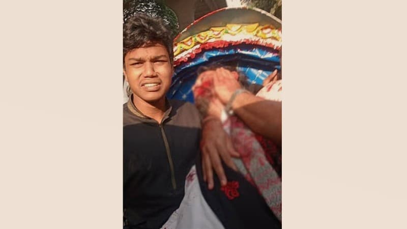 Bullet lodged in head, Hadi on life support: DMCH director