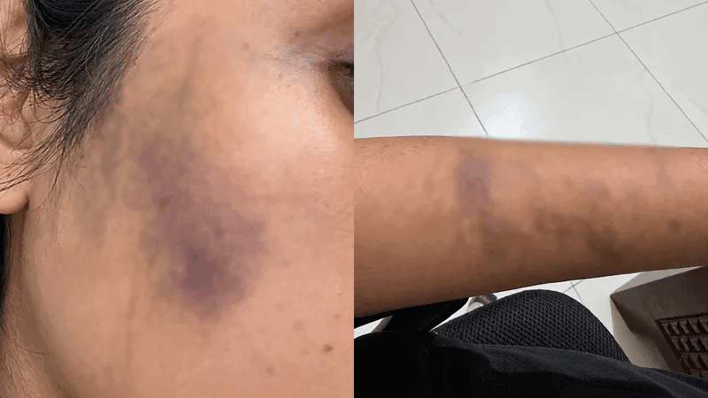 Young woman alleges assault for feeding dogs in Banasree