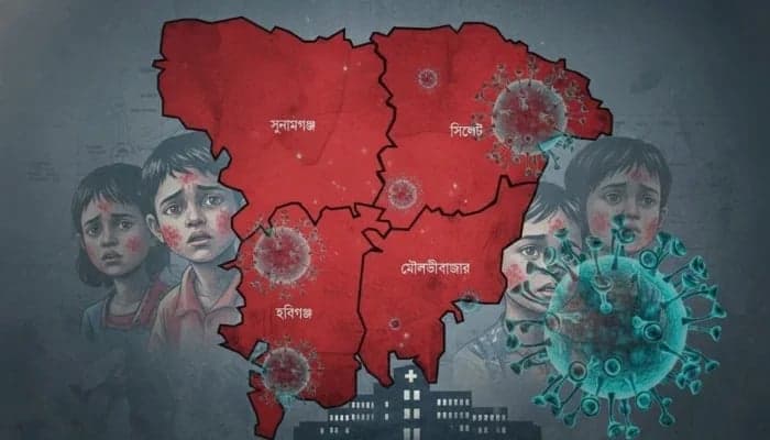 Measles death toll in Sylhet rise to 51
