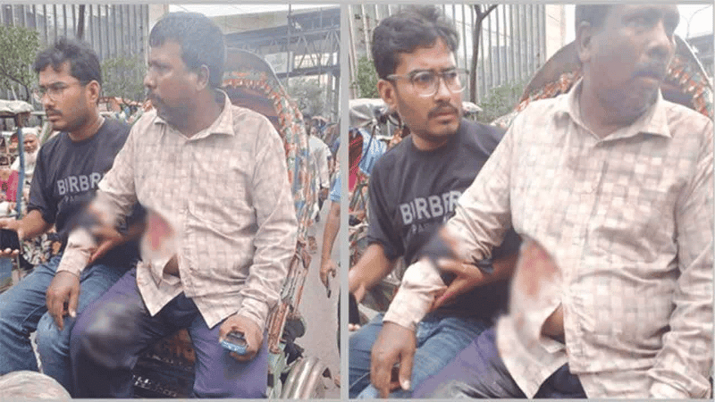 Businessman shot, Tk 17 lakh snatched in Motijheel
