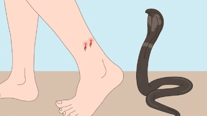 Argentina fan dies after watching WC final despite snake bite
