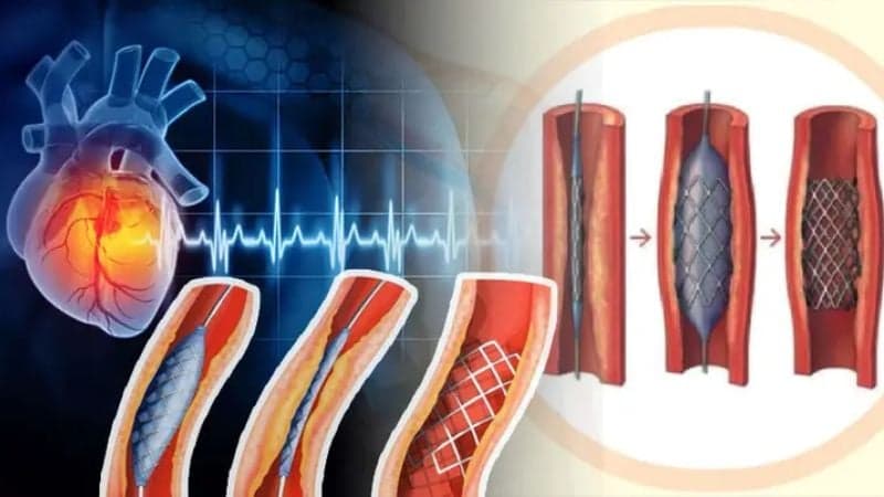 Price of heart rings may reduce by Tk20,000