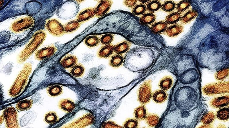 California declares state of emergency due to bird flu spreads