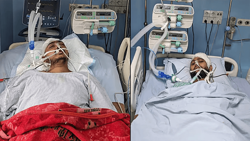2 CU students on life support after clash with locals