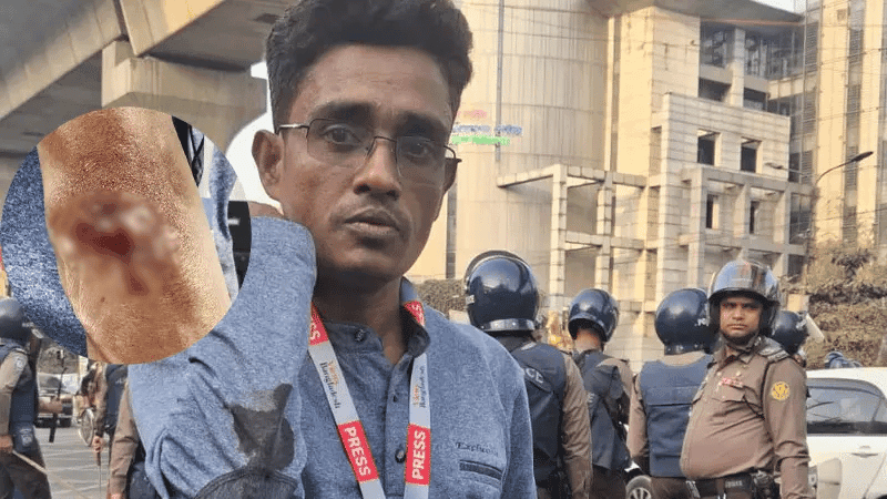 Police baton charge at Inqilab Mancha event, Views Bangladesh reporter wounded