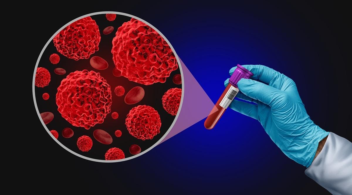 Groundbreaking study: Smart cancer drugs could replace chemotherapy
