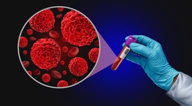 Groundbreaking study: Smart cancer drugs could replace chemotherapy