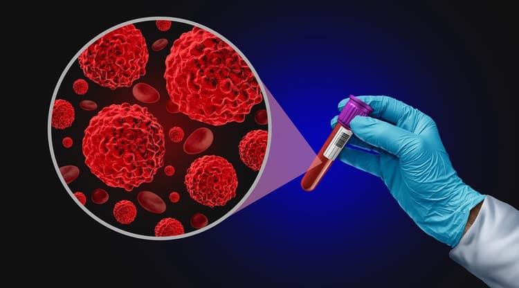 Groundbreaking study: Smart cancer drugs could replace chemotherapy