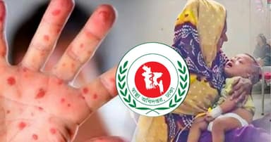 Measles outbreak: Three more children die in 24 hours