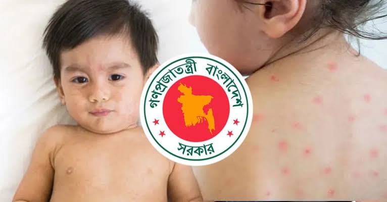 Measles claim lives of five more children, over 1,000 affected in 24 hours
