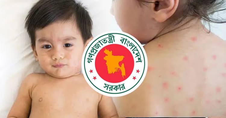 Measles claim lives of five more children, over 1,000 affected in 24 hours