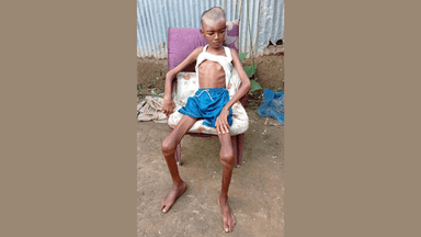 Shakil battles rare disease, family seeks help for treatment