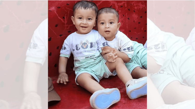 Measles claims lives of twin toddlers in Chattogram
