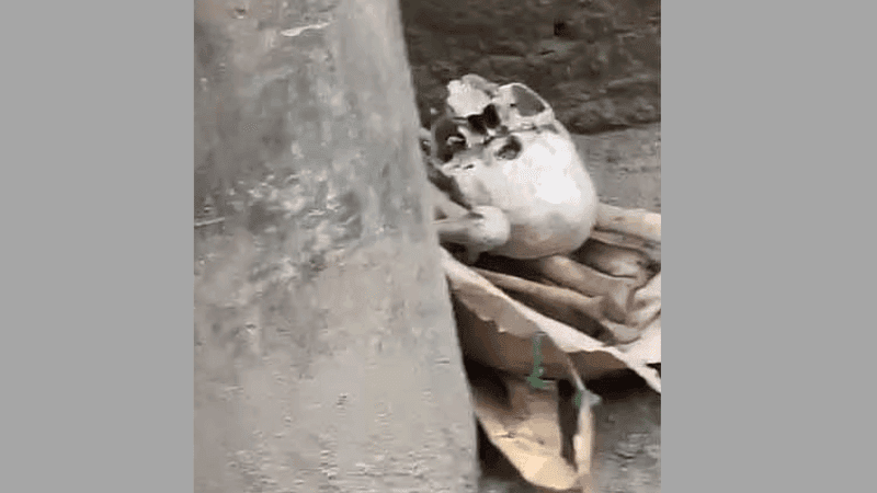 Skull, bones found on road in Mohammadpur