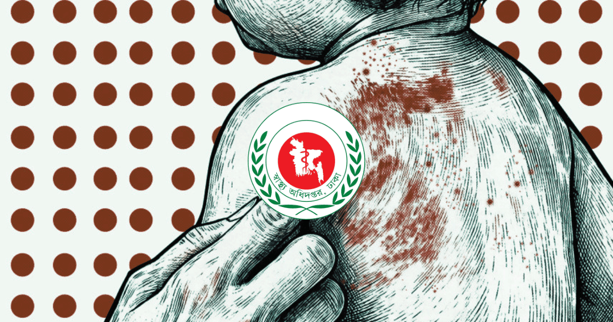 Six more children die with measles symptoms, total deaths reach 973