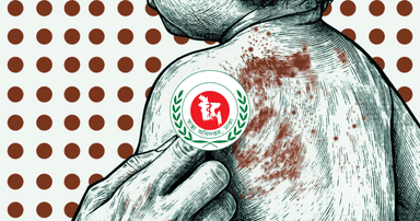 Deaths from measles and symptoms rise to 1,022