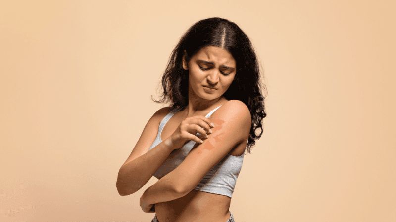 Why fungal infections peak during Monsoon—and how to stay safe
