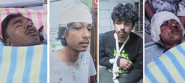 Seven injured in Gazipur admitted to DMCH