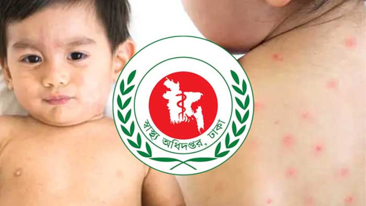 6 more children die from suspected measles in 24 hours