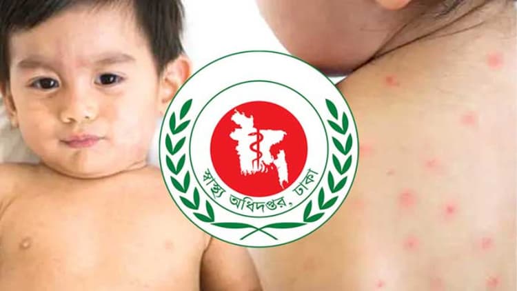 6 more children die from suspected measles in 24 hours