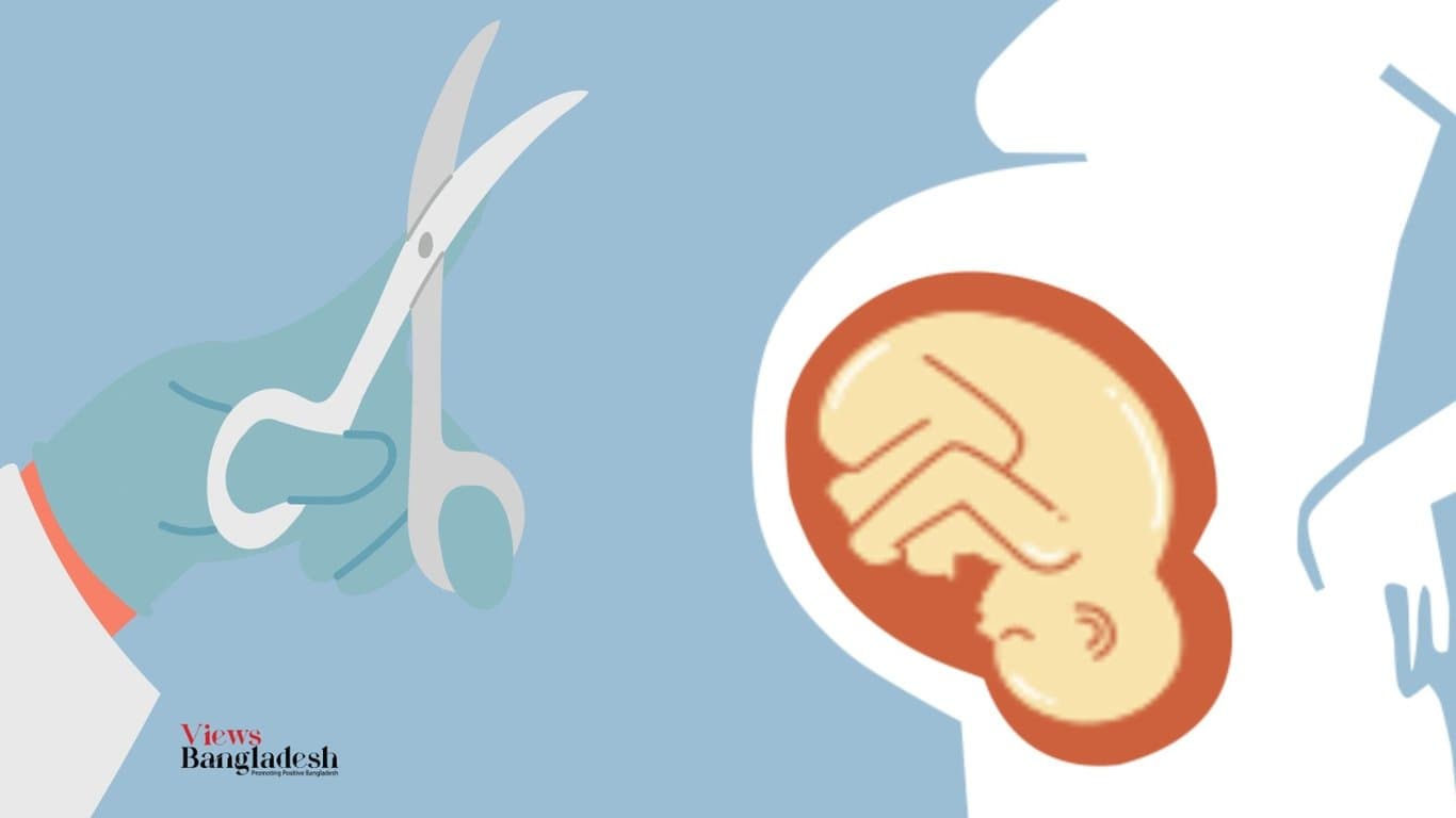 Cease unnecessary surgery on pregnant women