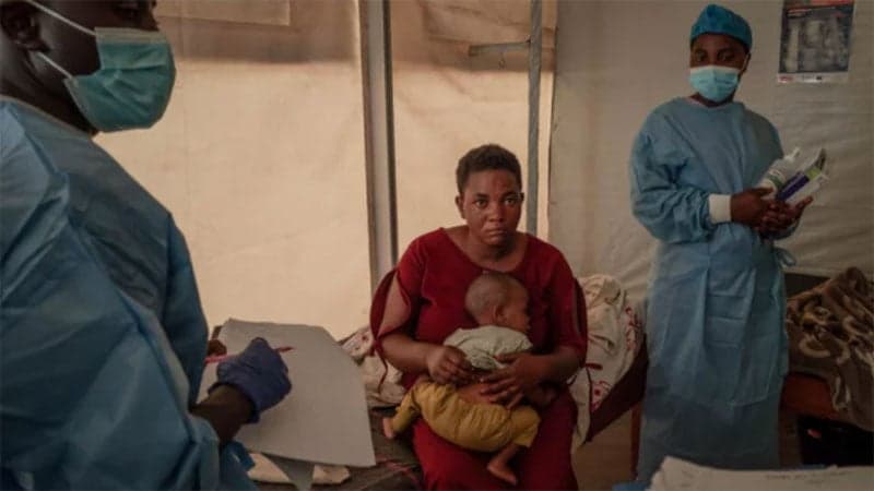 Burundi records 171 mpox cases